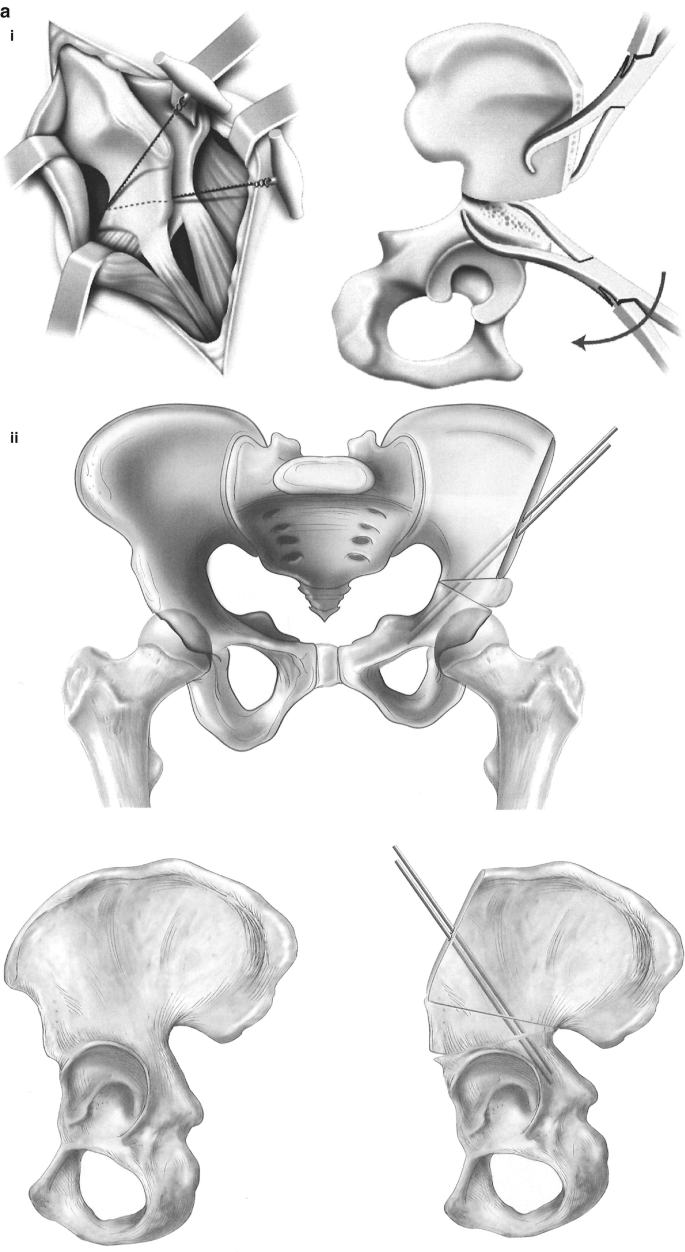 Left and middle: Two schoolbook illustrations hand-painted by Bertin