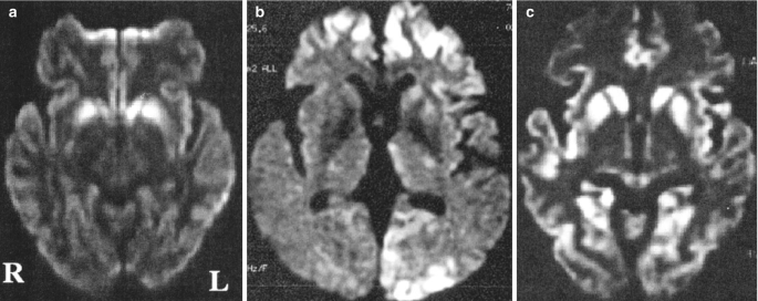 figure 37