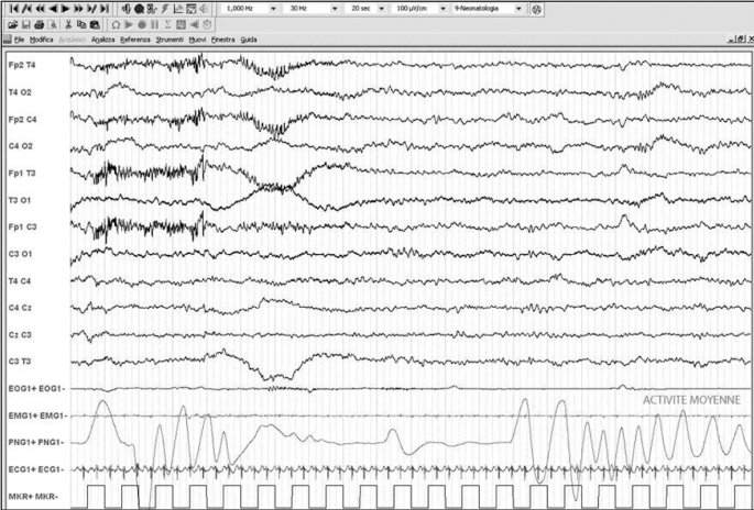 figure 21