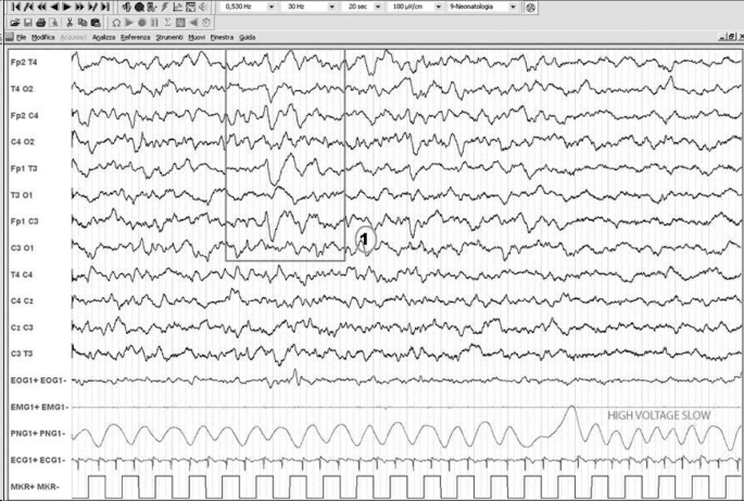 figure 24