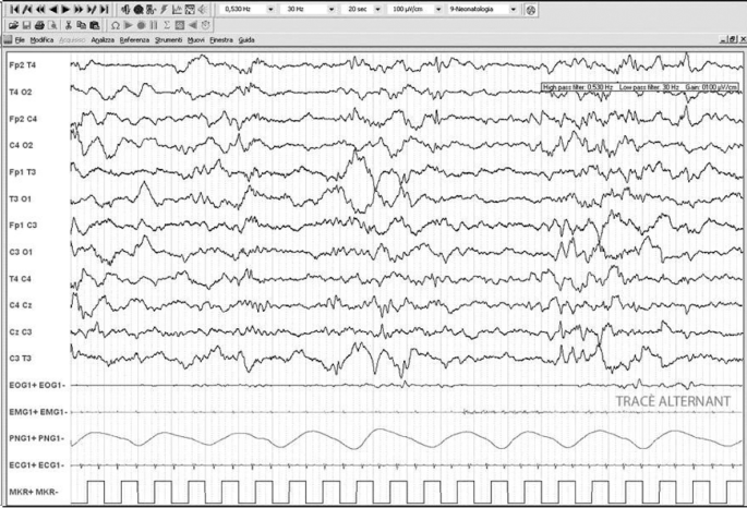 figure 32