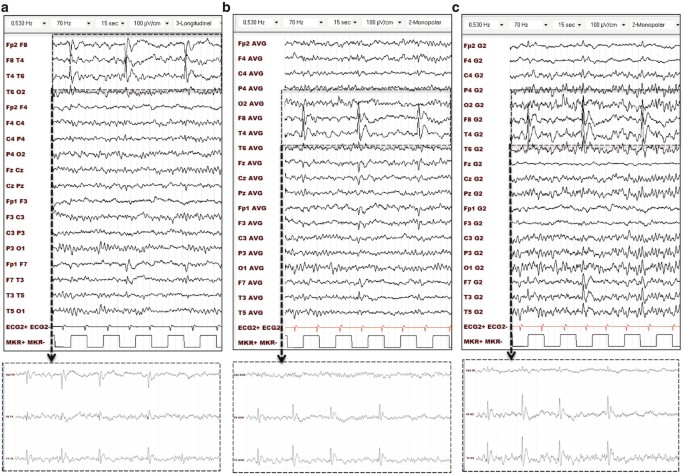 figure 17