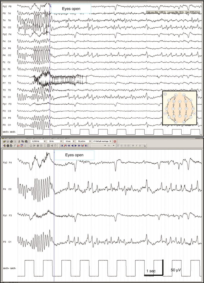 figure 17