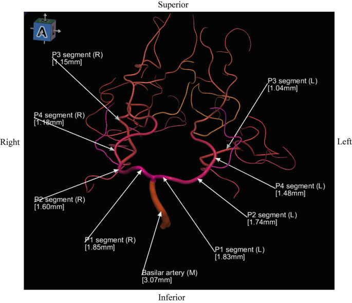 figure 20