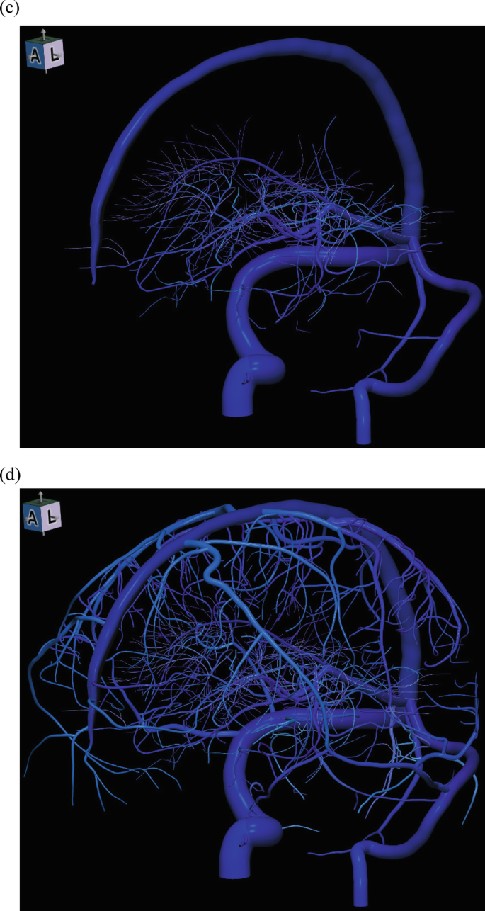 figure 22