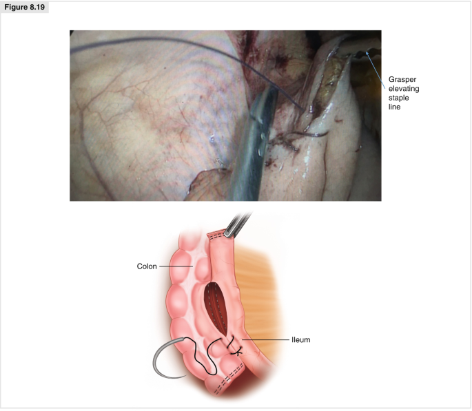 figure 19