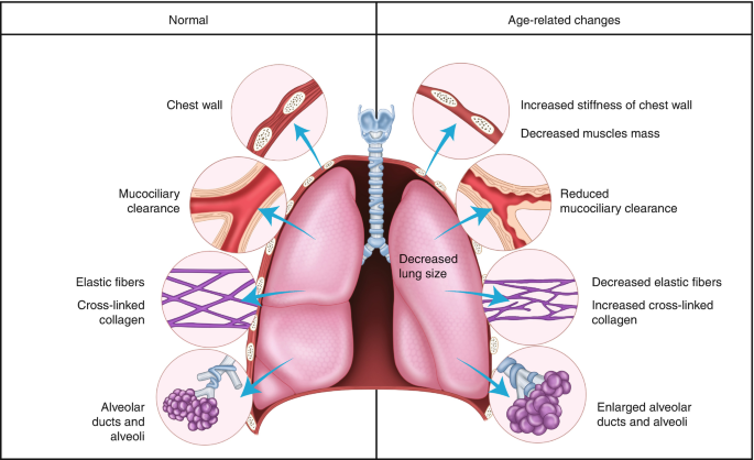 House cleaning linked to lung function decline