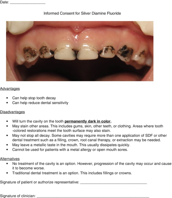 medical-management-of-dental-caries-springerlink