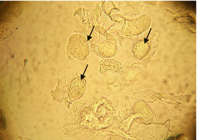 Diagnostic Approach to Pustular Diseases | SpringerLink