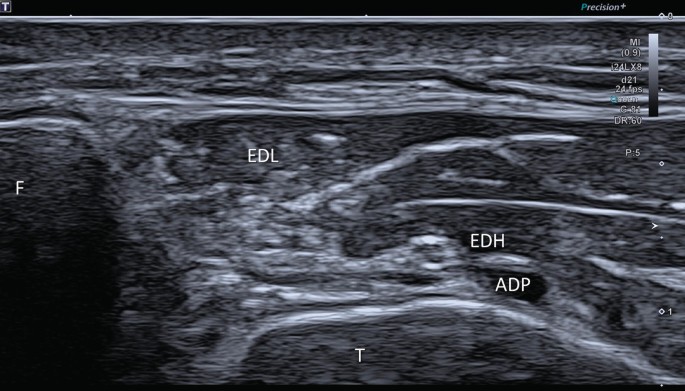 Thigh Lower Leg And Foot Springerlink Thigh Lower Leg And Foot Springerlink