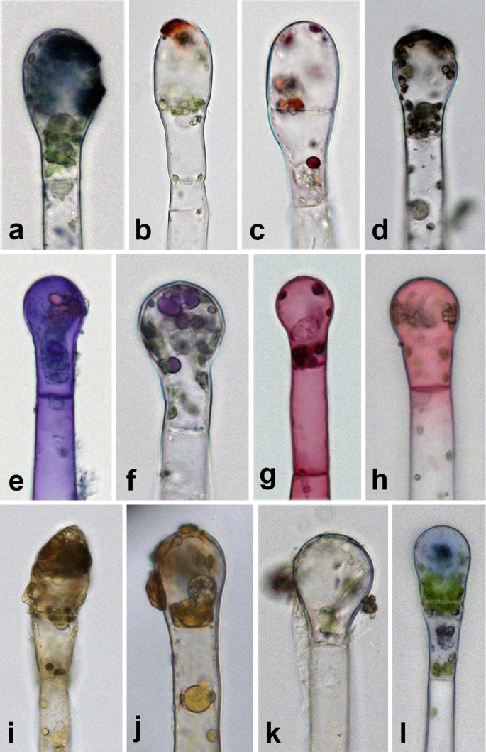 tobacco trichomes Glandular Trichomes on the Leaves of Nicotiana tabacum: Morphology,  Developmental Ultrastructure, and Secondary Metabolites