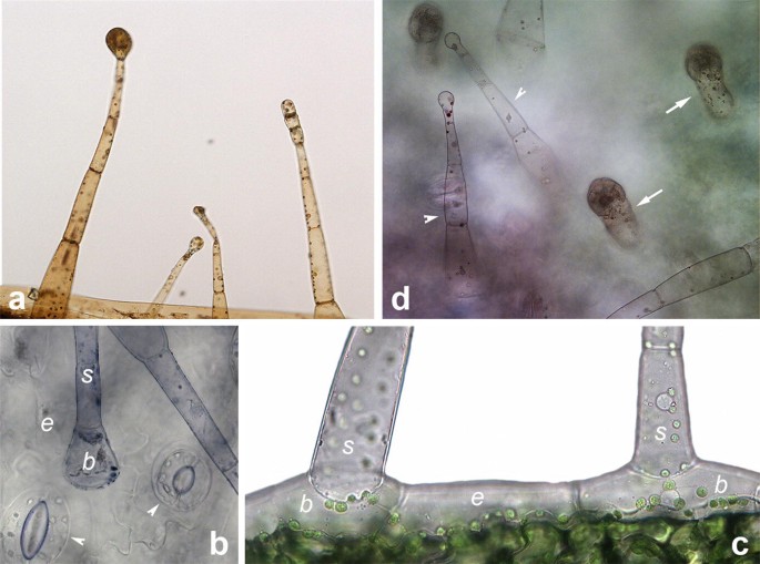 tobacco trichomes Glandular Trichomes on the Leaves of Nicotiana tabacum: Morphology,  Developmental Ultrastructure, and Secondary Metabolites
