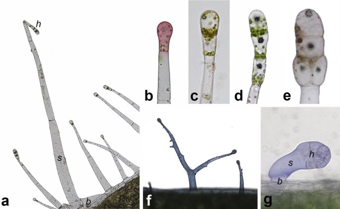 tobacco trichomes Glandular Trichomes on the Leaves of Nicotiana tabacum: Morphology,  Developmental Ultrastructure, and Secondary Metabolites