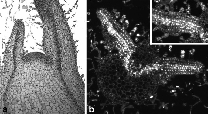tobacco trichomes Glandular Trichomes on the Leaves of Nicotiana tabacum: Morphology,  Developmental Ultrastructure, and Secondary Metabolites