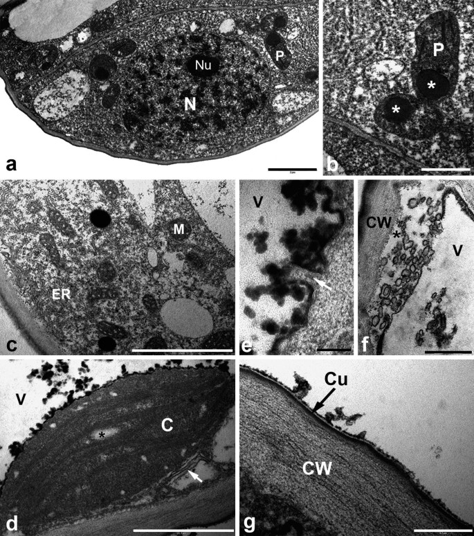 Glandular Trichomes on the Leaves of Nicotiana tabacum: Morphology,  Developmental Ultrastructure, and Secondary Metabolites