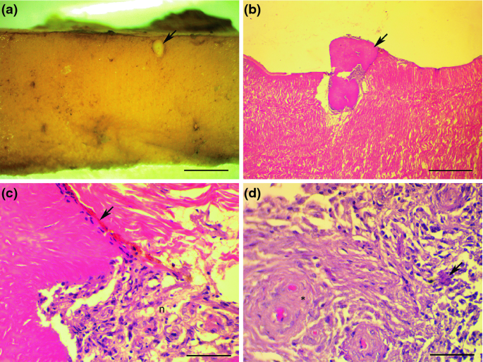 figure 18