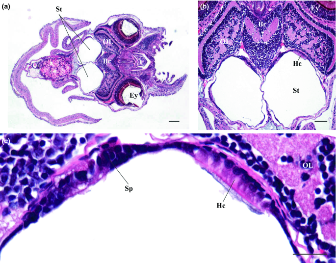 figure 18