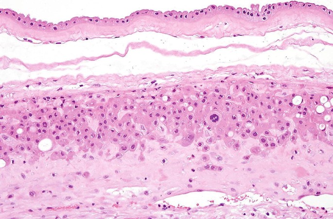 Placenta | SpringerLink
