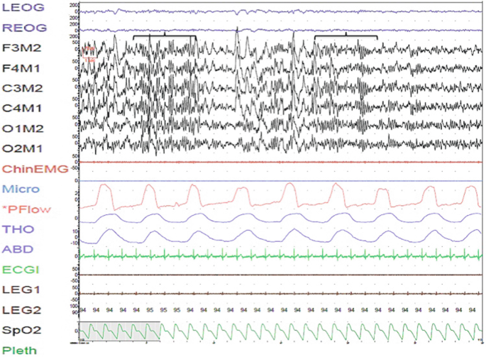 figure 14