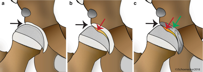 figure 18