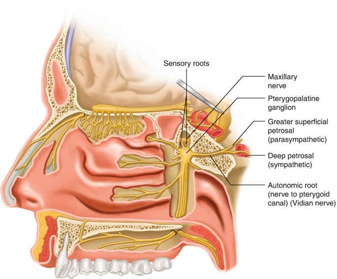 Sphenopalatine Ganglion Block | SpringerLink