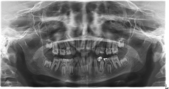 Ortoapnea - Odos Dental