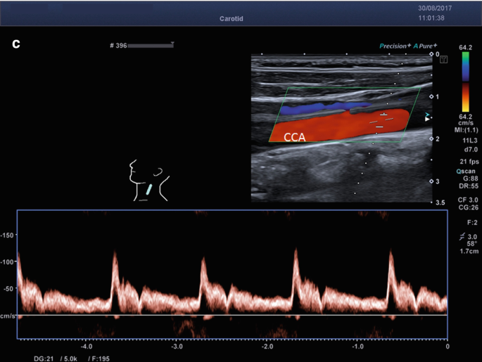 figure 20