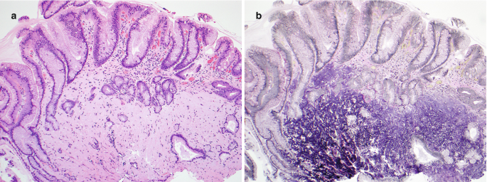 figure 35