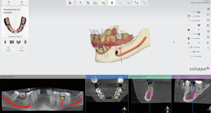 figure 14