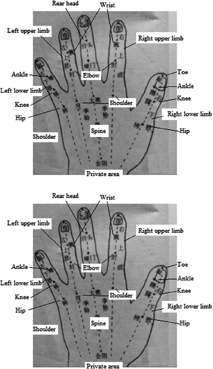 Acupuncture Styles in Current Practice | SpringerLink
