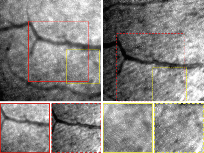 figure 17