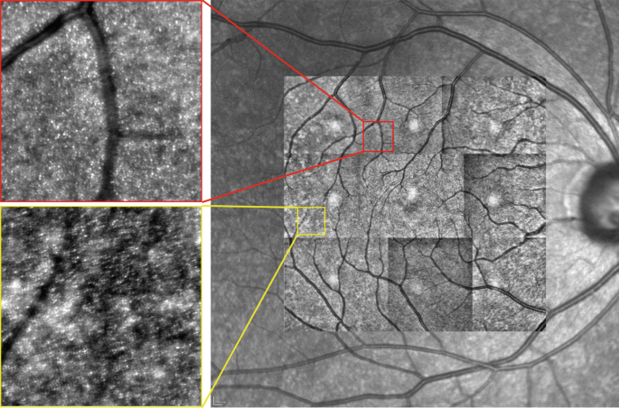 figure 19