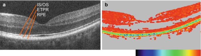 figure 19