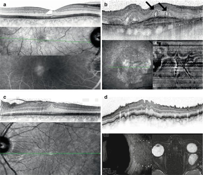 figure 14