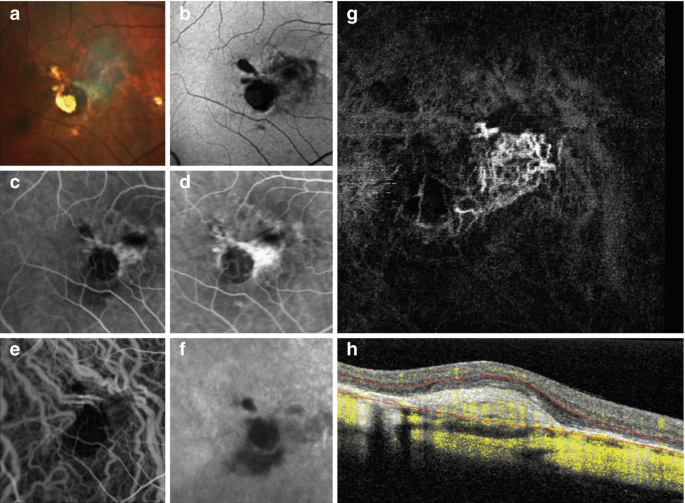 figure 16