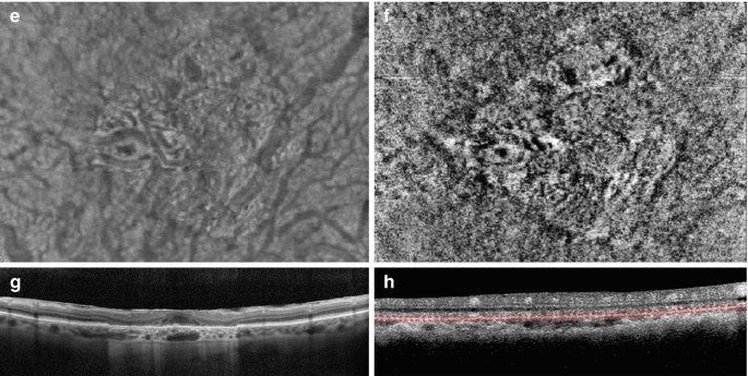 figure 20