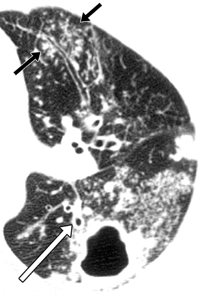 figure 34