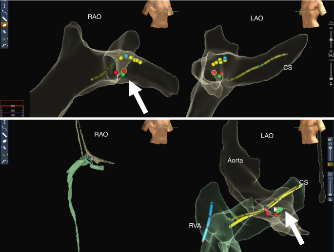 figure 25