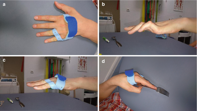 Assistive Devices for Arthritis of the Hands