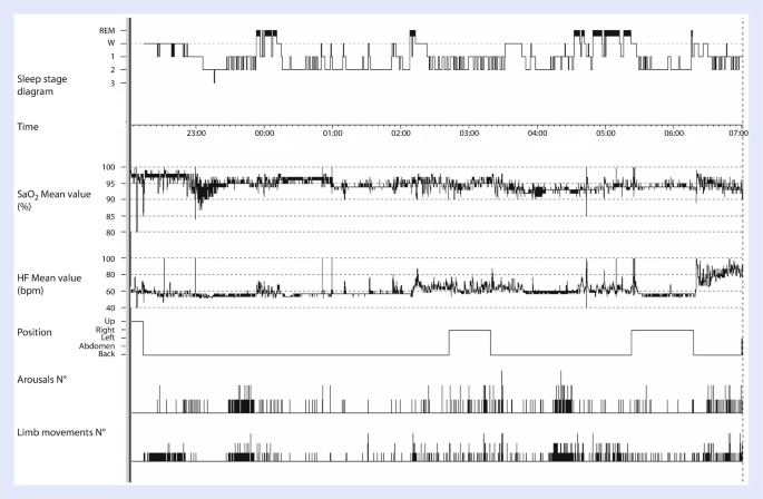 figure 15