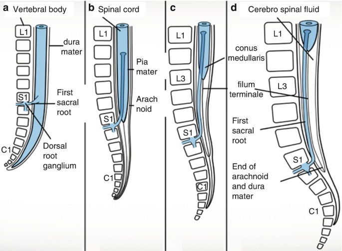 Tethered Cord Syndrome | SpringerLink