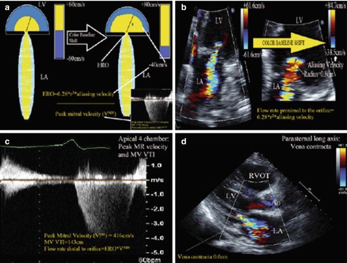 Echocardiography | SpringerLink