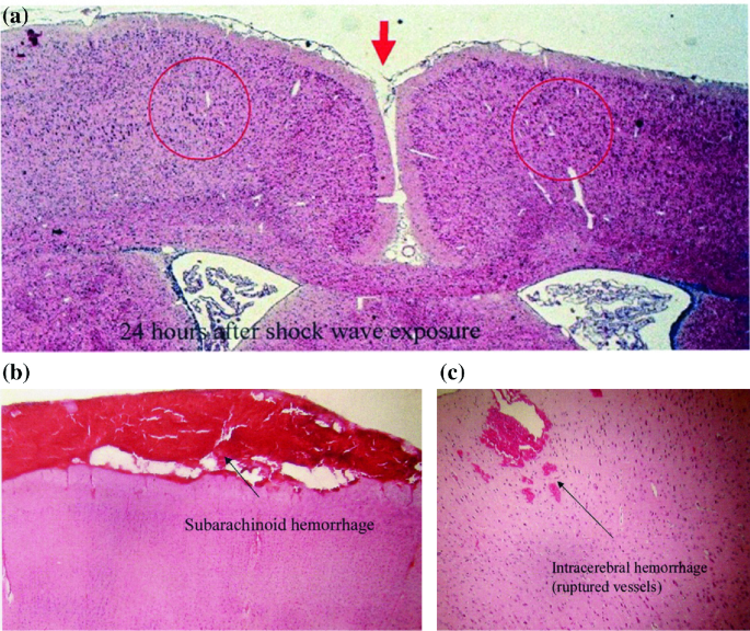 figure 25