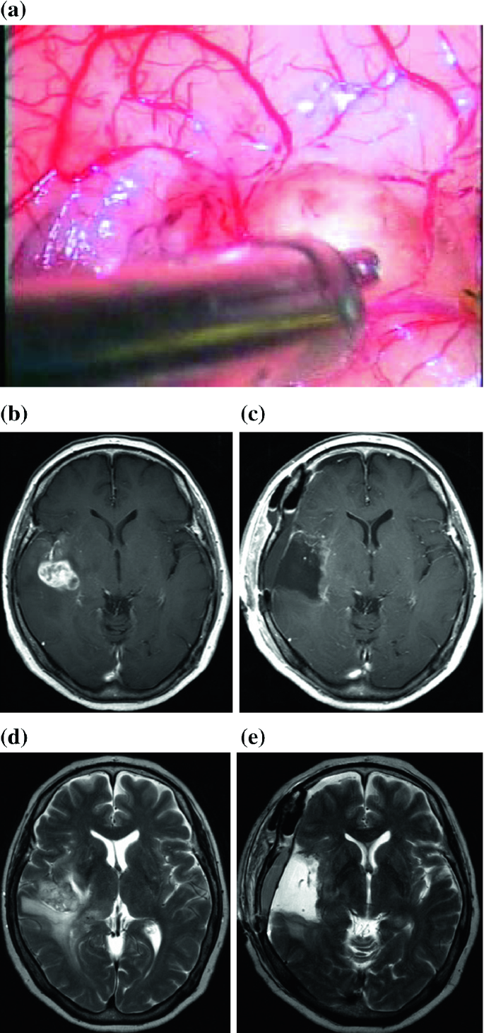 figure 33