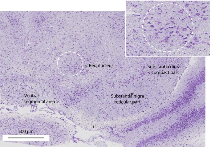 Substantia nigra und ventraler tegmentaler Bereich