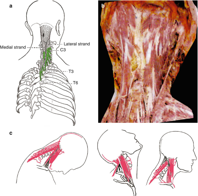 ANAT 411 Anterior View of the Muscles of Head & Neck Diagram