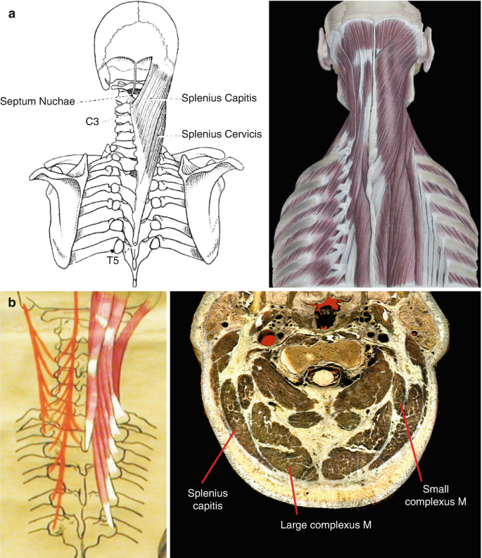 ANAT 411 Anterior View of the Muscles of Head & Neck Diagram