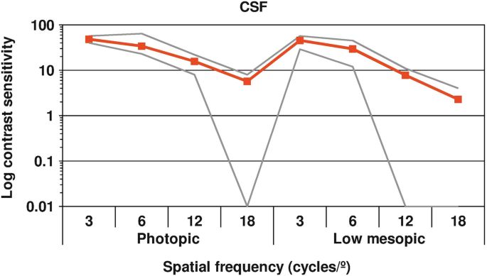 Multifocal Intraocular Lenses: Sector Rotational Asymmetrical Refractive  Lenses | SpringerLink