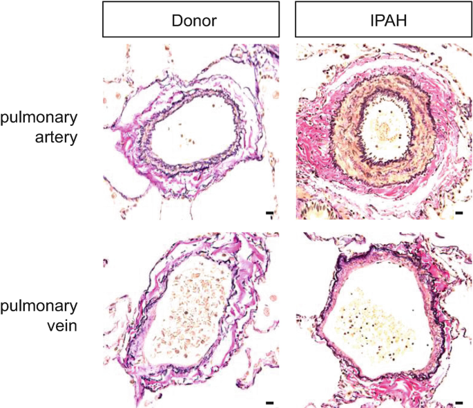 pulmonary artery histology