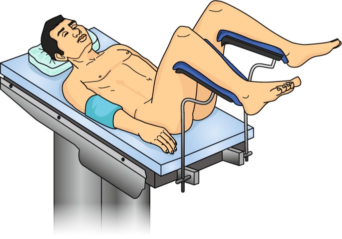 Fig. 12.1, [Supine position with typical pressure points]. - Compartment  Syndrome - NCBI Bookshelf